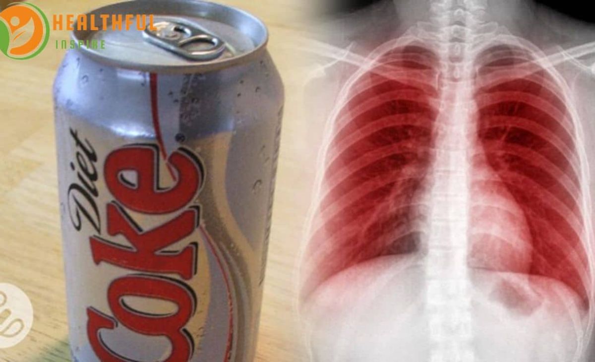 impact-of-diet-coke-on-kidney-health